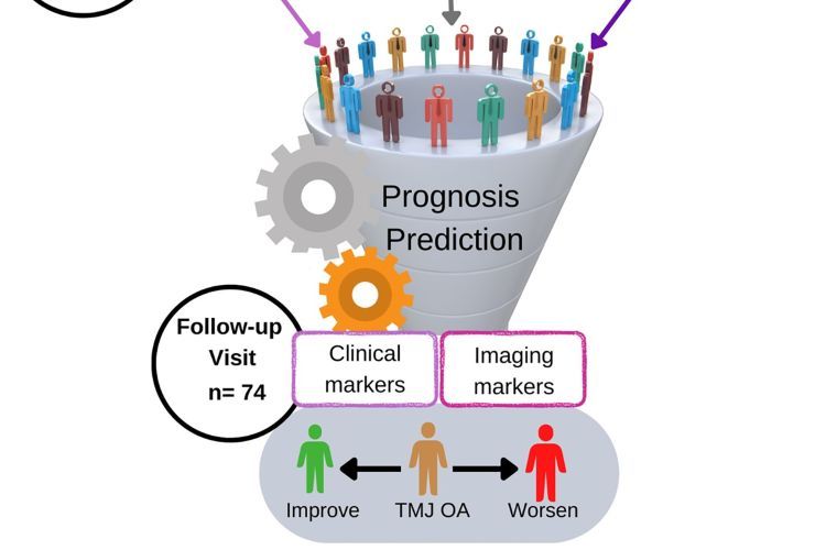 Schematic representation for the steps of the TMJ OA prognosis prediction model’s development. (A) Clinical, imaging, and biological data were collected from the study subjects, at baseline, and utilized to create the OA Prognosis Prediction model. (B) Clinical and imaging data were collected, at follow-up visits, to label the training dataset with the changes of the participants’ health status following 2 to 3 y of conservative management.